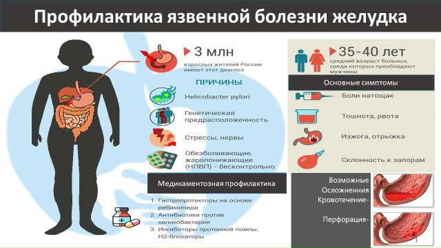 Профилактика_язвенной_болезни_желудка.jpg