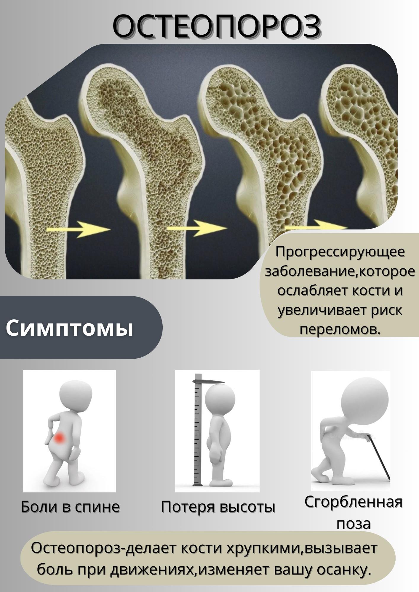 Остеопороз.jpg