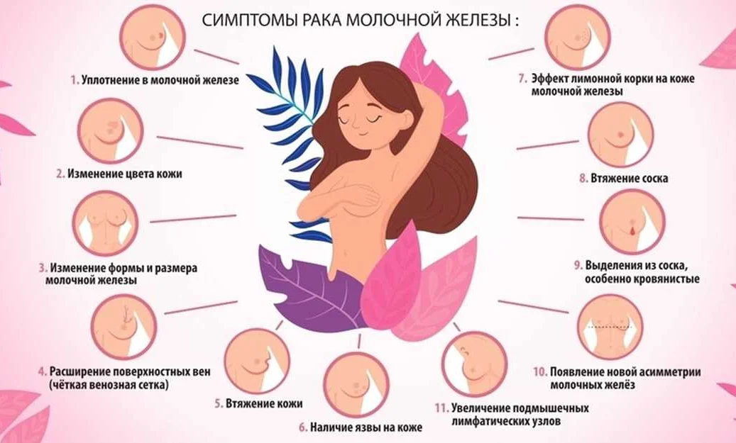 симптомы_рака_молочных_железы.webp
