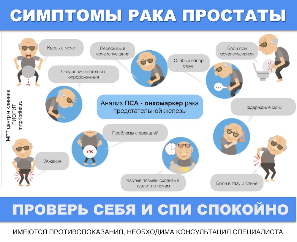 симптомы_рака_простаты.jpg